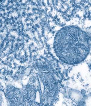 Mouse Anti- Papilloma Virus 16 late protein L1 IgG (HPV16L1) Elisa kit | Technique alternative | 01014439271