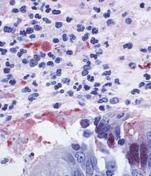 HPV16 E7 antibody Red | Technique alternative | 01011935487