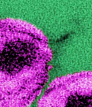 Papilloma Virus (HPV) Clone: K1H8, Mouse Monoclonal antibody- paraffin, IH | Technique alternative | 01010457316