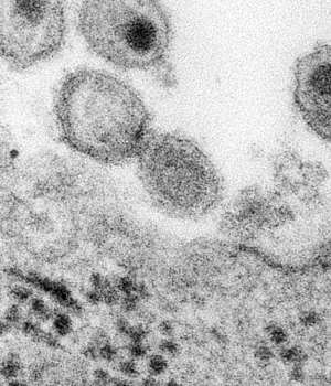 Rubella, Strain HPV-77 (German Measles) (FITC) | Technique alternative | 01022533825
