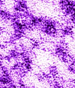 Mouse Anti- Papilloma Virus 33 late protein L1 (HPV33L1) IgG ELISA kit, quantitative, 96 | Technique alternative | 02011970328