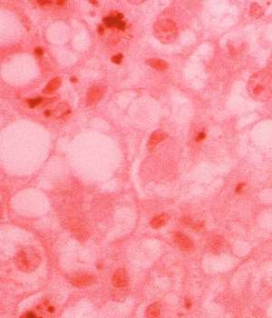 Mouse Anti- Papilloma Virus 18 late protein L1 (HPV18L1) IgG ELISA kit, quantitative, 96 | Technique alternative | 02011975280